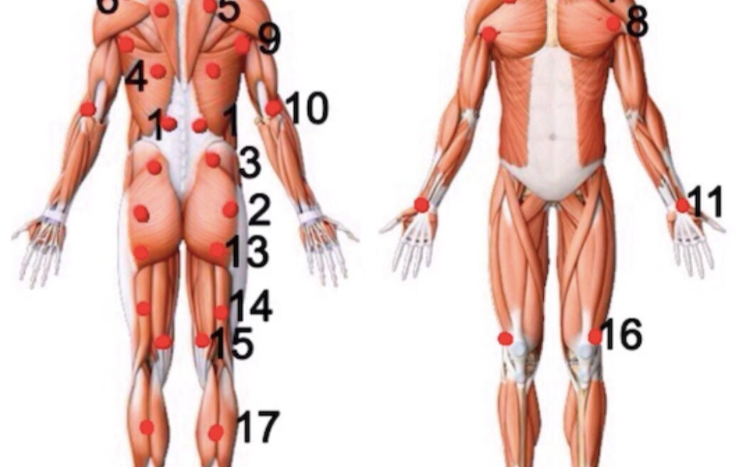 Tensions musculo squelettiques : comprendre le lien avec le stress et la posture